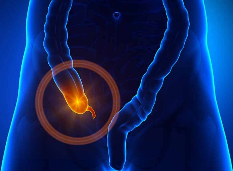 Small Intestine & Appendix Surgery 