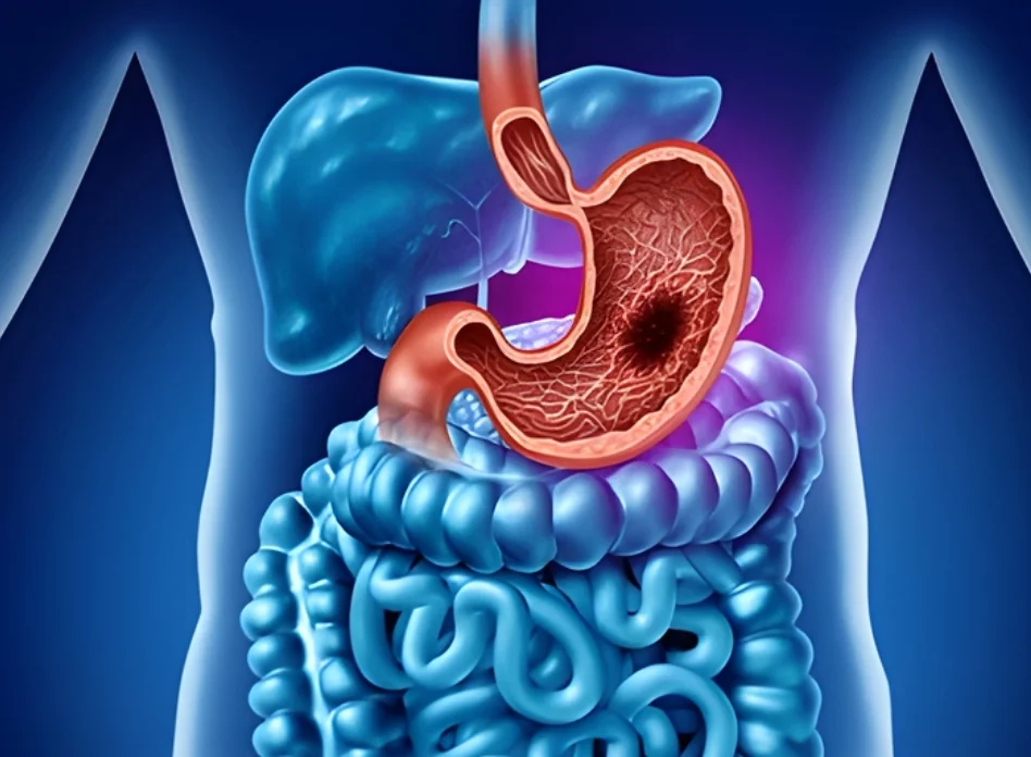 Gastrointestinal Cancer Surgery