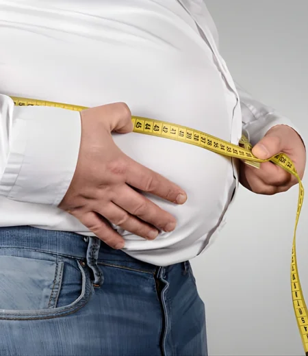 Surgical care for obesity