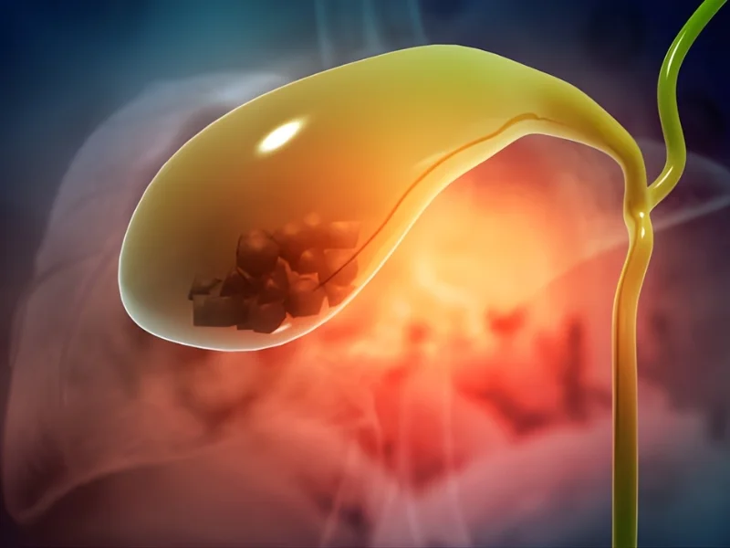 Risk Factor For Gallbladder Cancer