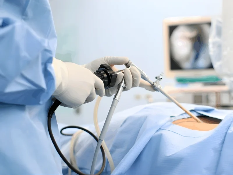 Reduced Postoperative Pain