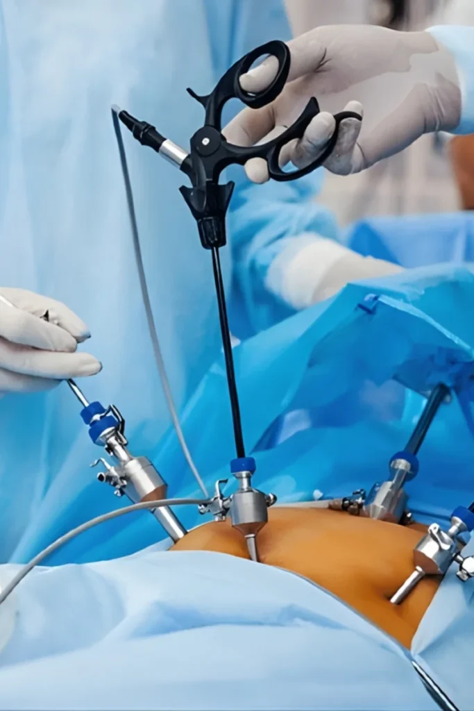 benefits of laparoscopic surgery