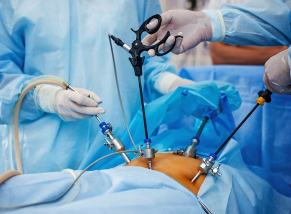 Advanced Laparoscopic Surgery